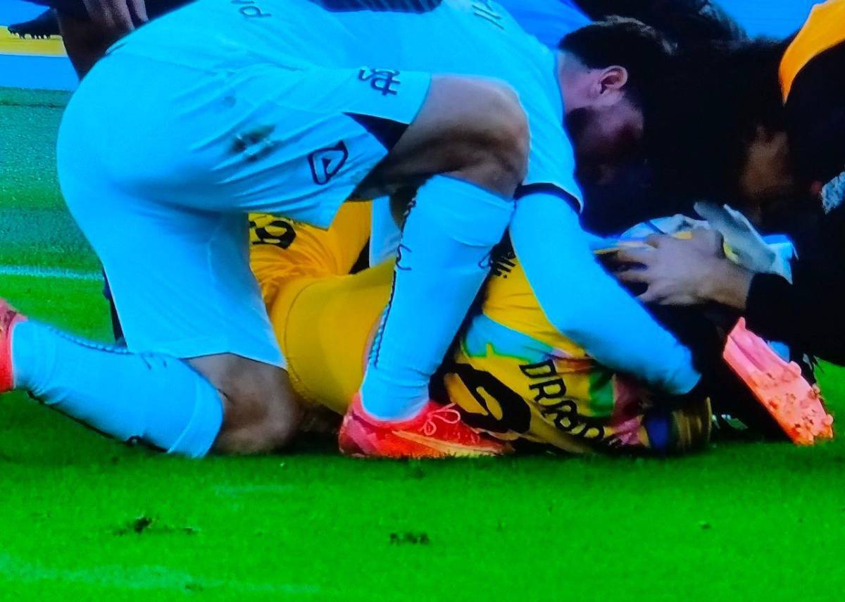 No apto para sensibles: La terrible lesión de tobillo que sufrió jugador de Polonia que se perderá el Mundial de Qatar