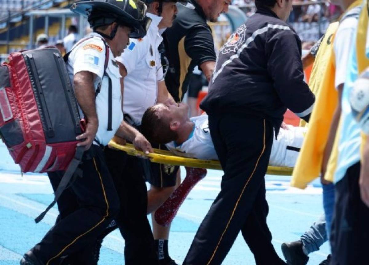 La espeluznante lesión de un jugador de Comunicaciones ante Municipal en Guatemala