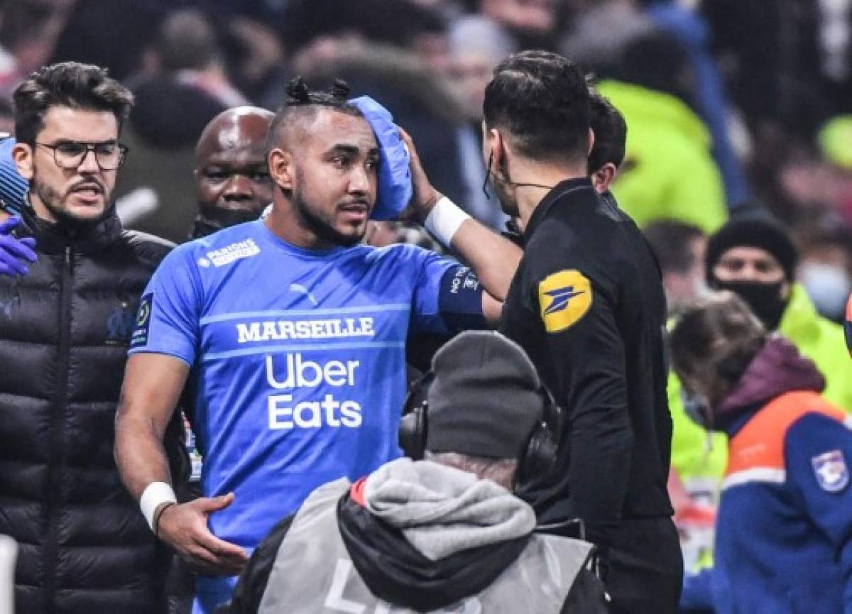 Fotos: Así fue la agresión que sufrió Payet en la Liga de Francia; ¡botellazo en la cabeza!