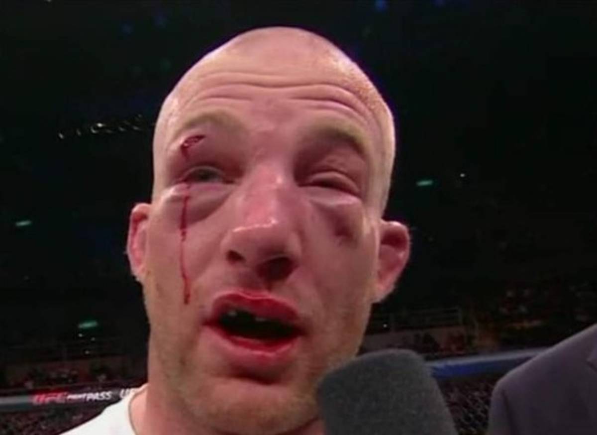 Fotos: Los golpes más espeluznantes en la UFC