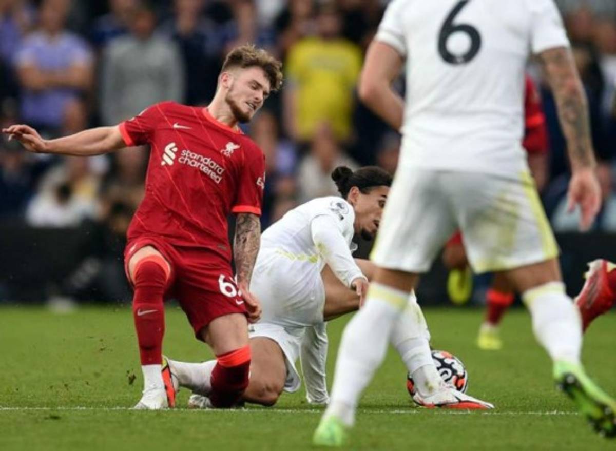 No apto para sensibles: Así fue la escalofriante lesión de Harvey Elliott del Liverpool; sufrimiento y shock de Klopp  