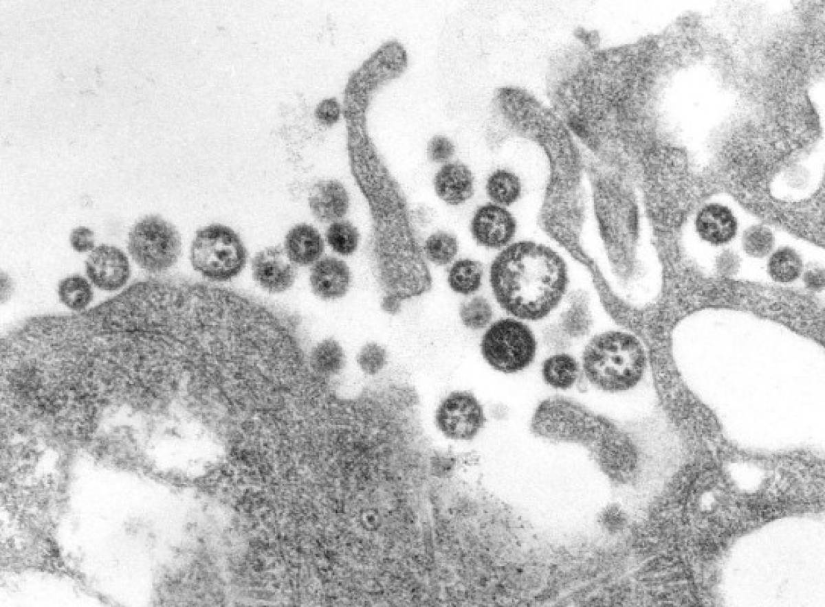 ¡Transmitidos por ratas, monos y aves! Estos son los 10 virus más letales en el mundo