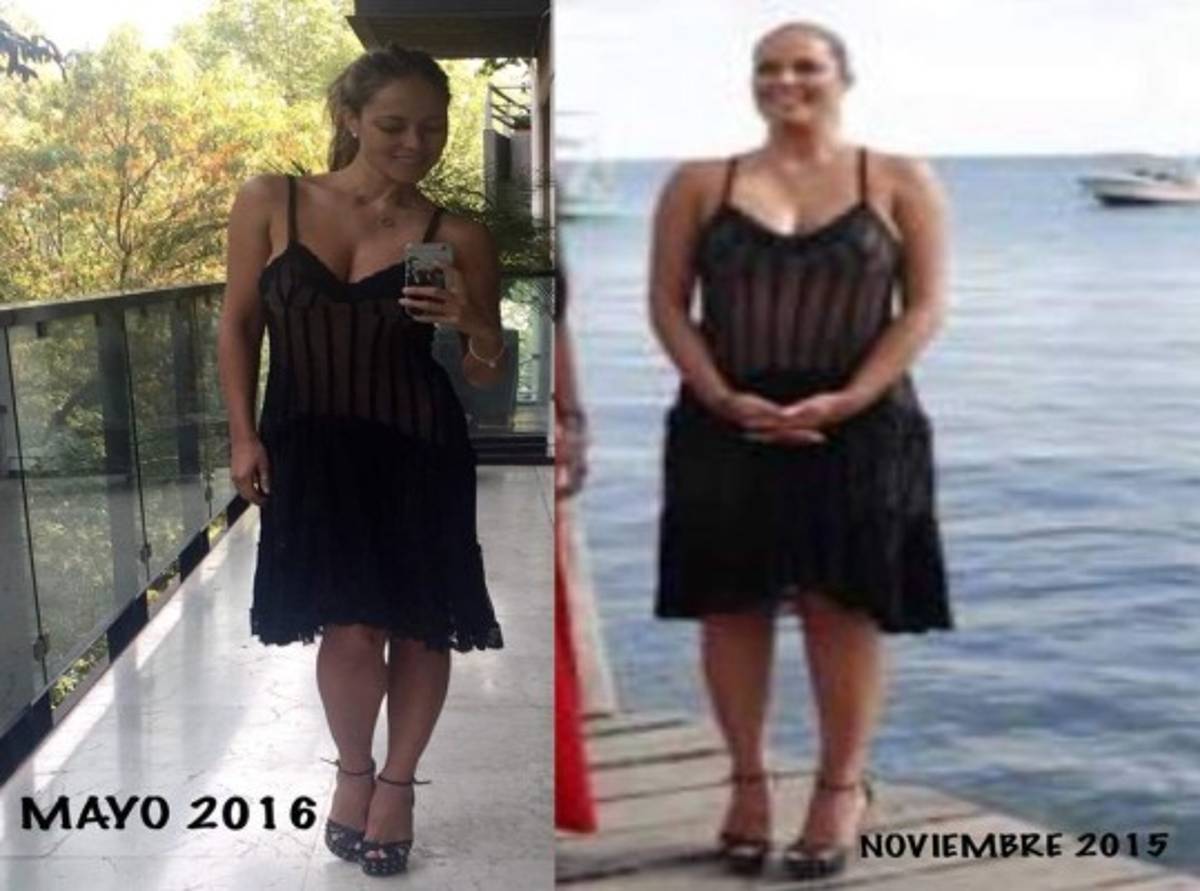 ¡INCREÍBLE! El antes y después de Vanessa Huppenkotten, en México dicen que va a 'desaparecer'