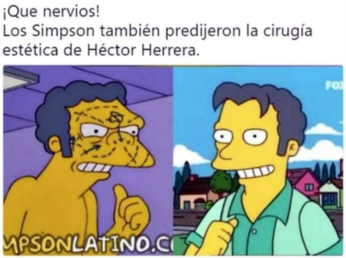 ¡Héctor Herrera es acribillado con memes tras sus cirugías plásticas!