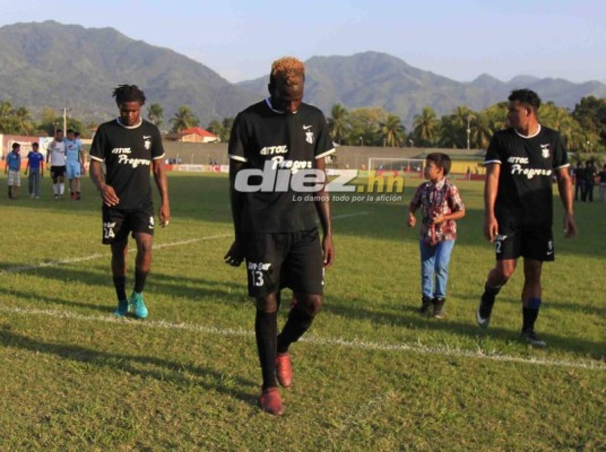 NO VISTE EN TV: Lluvia de huevos, pancartas en el Nacional y chicas lindas