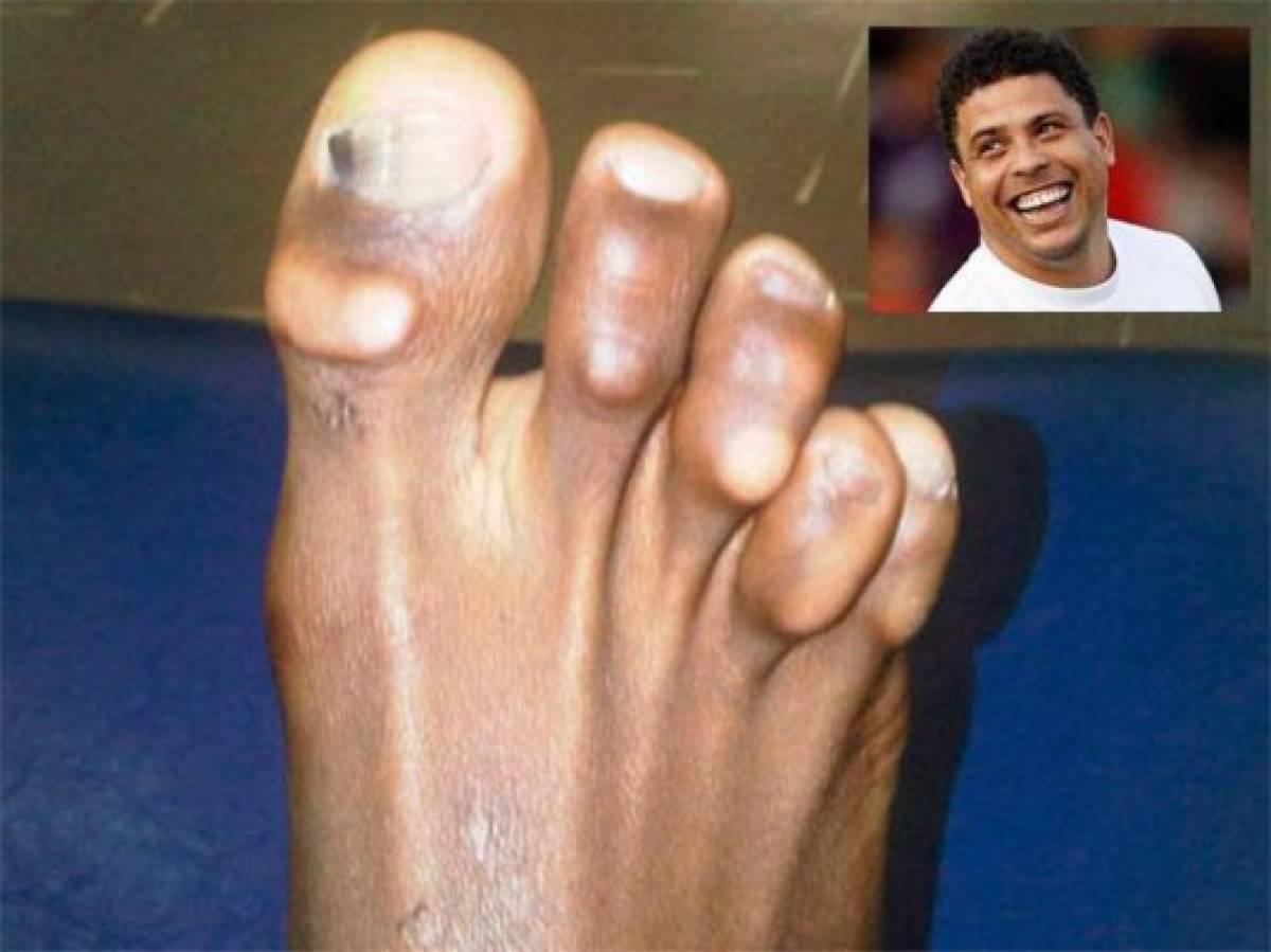 ¡Al descubierto! Así son los pies más feos de algunos deportistas reconocidos a nivel mundial; los de CR7 y Lebron son horribles