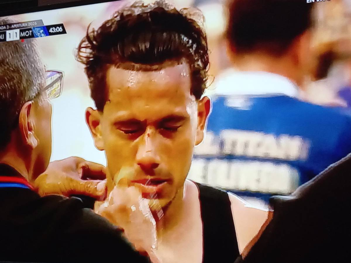 Así quedó el rostro de Edwin tras la agresión, el error y el gesto de Espinel
