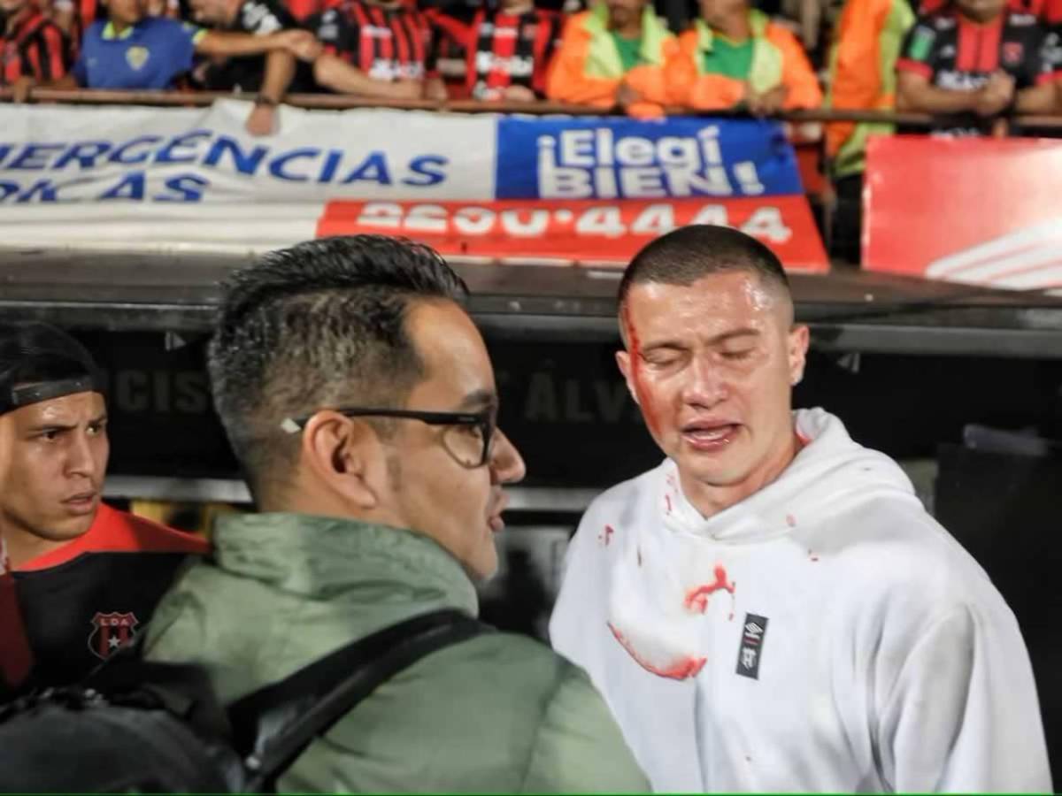 Batalla campal en Costa Rica: Así fue el zafarrancho entre Alajuelense-Herediano en la gran final, ¡golpes y sangre!
