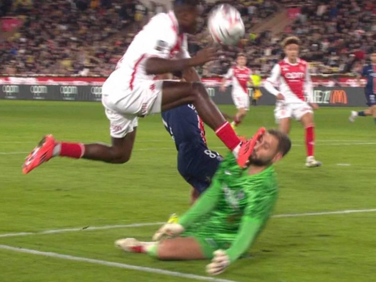 La impactante lesión de Donnaruma que recibió una patada en el rostro y tuvo que ser reemplazado ante Mónaco