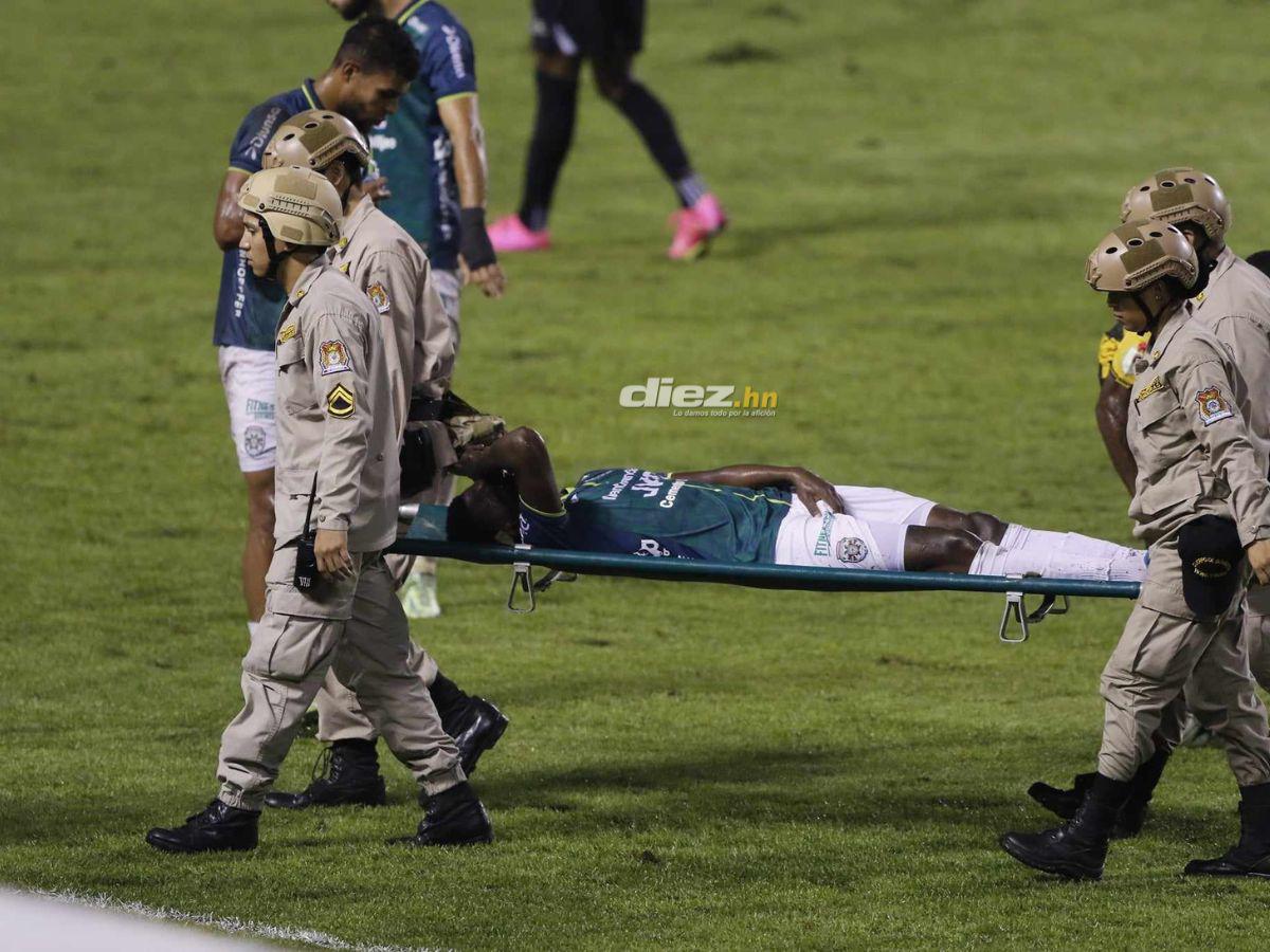 No se vio en TV: El zafarrancho en el Olímpico, bronca del Real España, la locura de Sacaza, ¿qué pasó en La Ceiba?