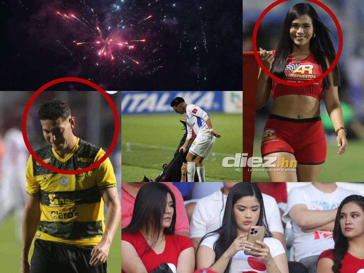 El llanto de futbolista del Real España, Michaell Chirinos se bajó a Troglio y el hincha que se golpeó en pleno clásico