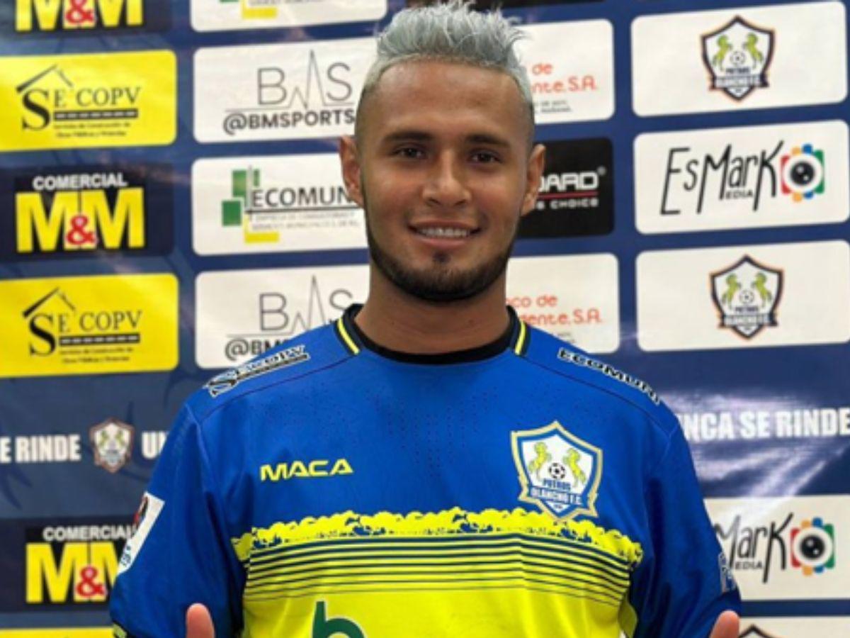 ”Pistolero”, “Pibe”, “El Chelito”: Estos son los apodos más famosos en la Liga Nacional, ¿por qué les dicen así?