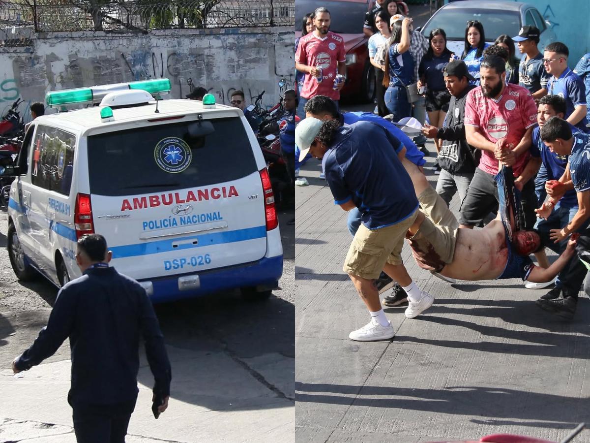Tres heridos dejaron los actos vandálicos entre las barras de Motagua y Olimpia: ¿hay muertos? Esto informan