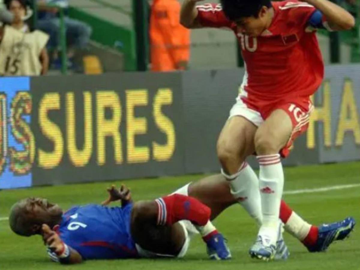 Romario se suma: sufrieron las lesiones más escalofriantes en el fútbol