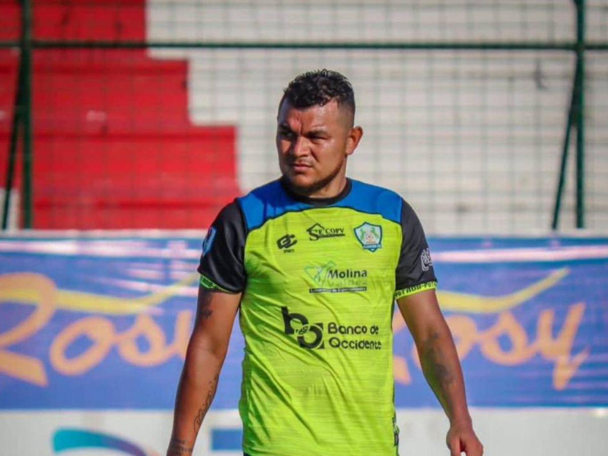 ”Pistolero”, “Pibe”, “El Chelito”: Estos son los apodos más famosos en la Liga Nacional, ¿por qué les dicen así?