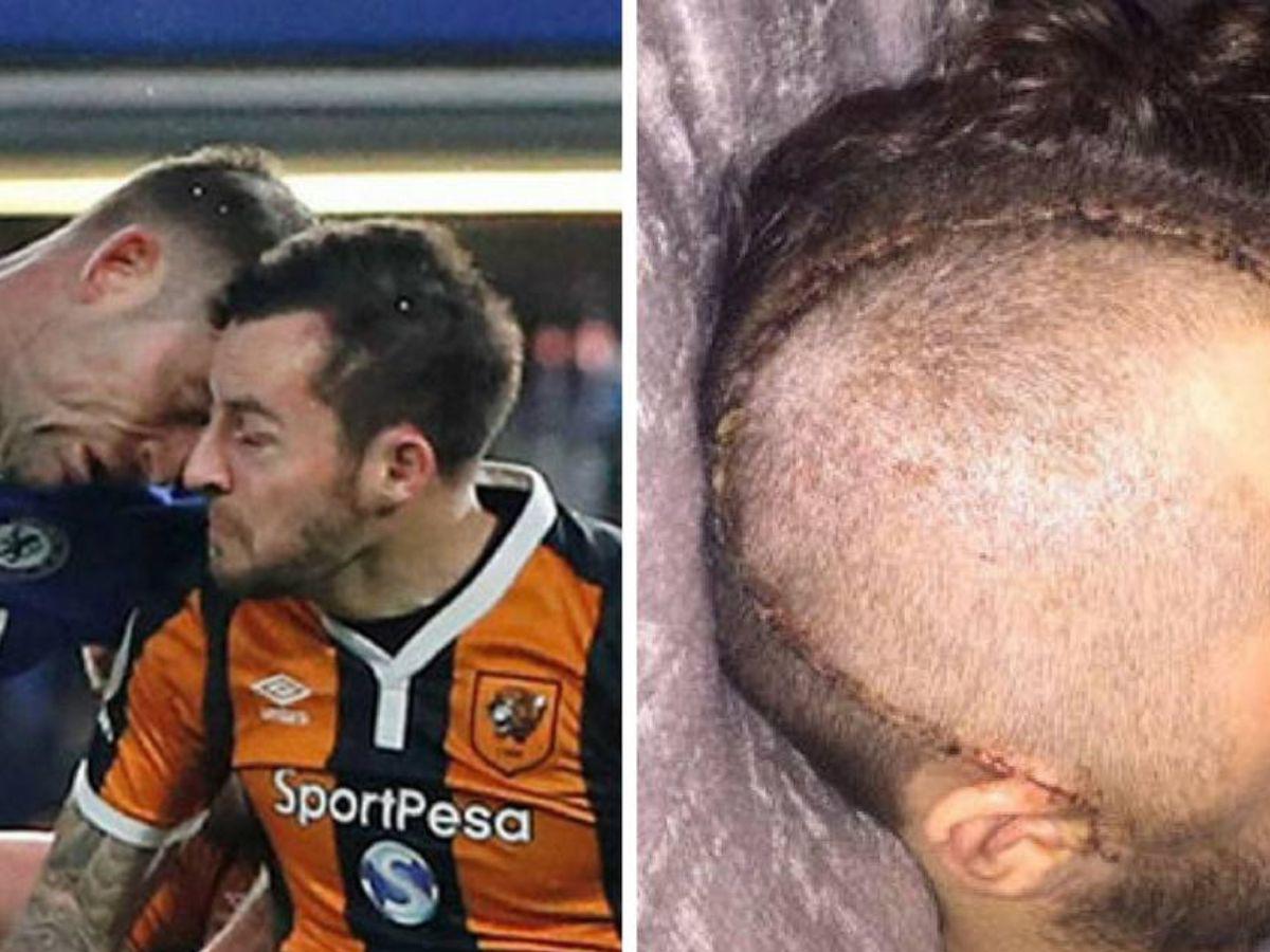 La Premier League es la más peligrosa: La lista de las escalofriantes fracturas de cráneo en el fútbol; uno se retiró