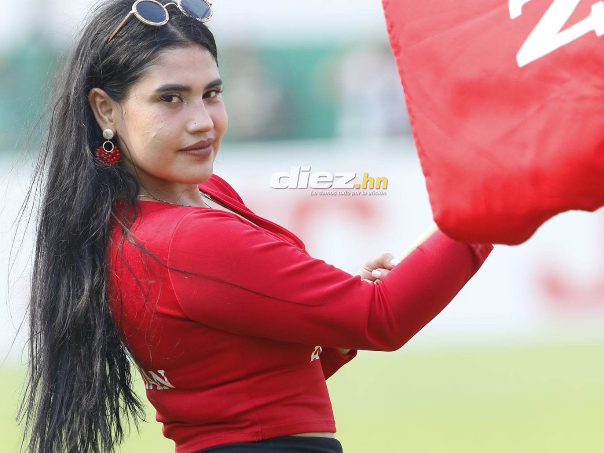 Las bellas aficionadas del Marathón, el Yankel Rosenthal sin “luz” y la espantosa lesión de Clayvin Zúniga