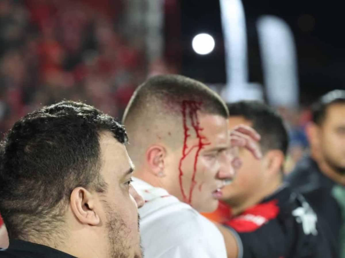 Batalla campal en Costa Rica: Así fue el zafarrancho entre Alajuelense-Herediano en la gran final, ¡golpes y sangre!