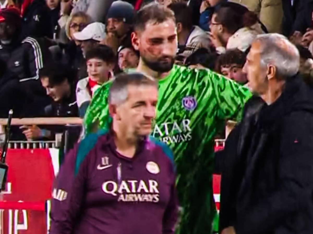 La impactante lesión de Donnaruma que recibió una patada en el rostro y tuvo que ser reemplazado ante Mónaco