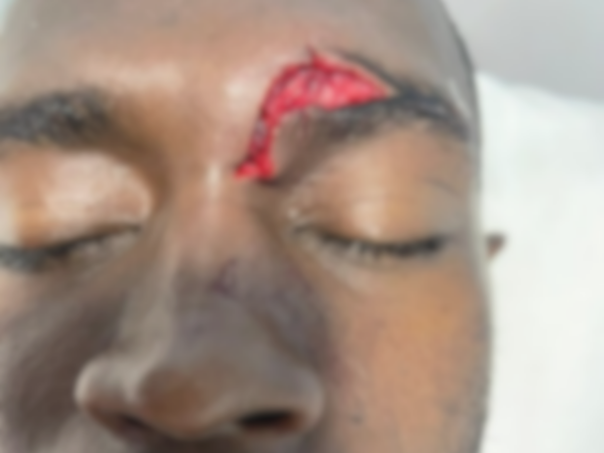 Imágenes espeluznantes: las terribles heridas de los jugadores del Independiente tras bronca en el estadio del Parillas One