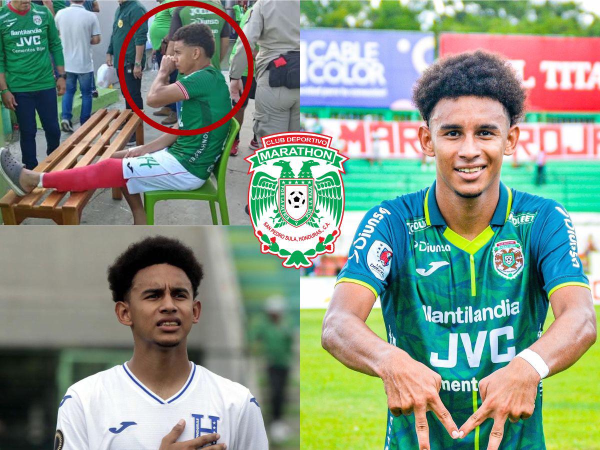 Se rompió los ligamentos cruzados en Marathón y acaricia su regreso: ¿Cuál es la realidad de Javier Arriaga?