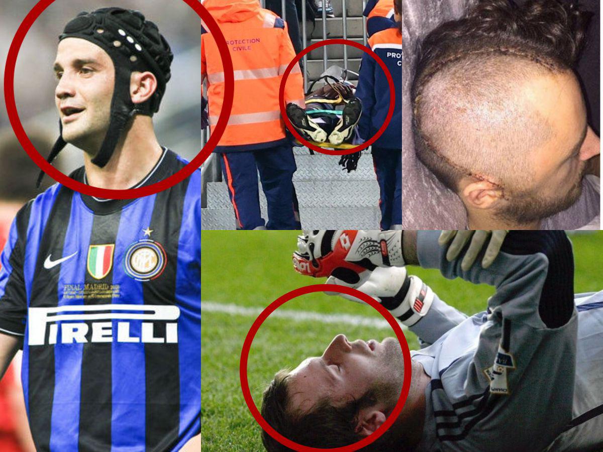 La Premier League es la más peligrosa: La lista de las escalofriantes fracturas de cráneo en el fútbol; uno se retiró