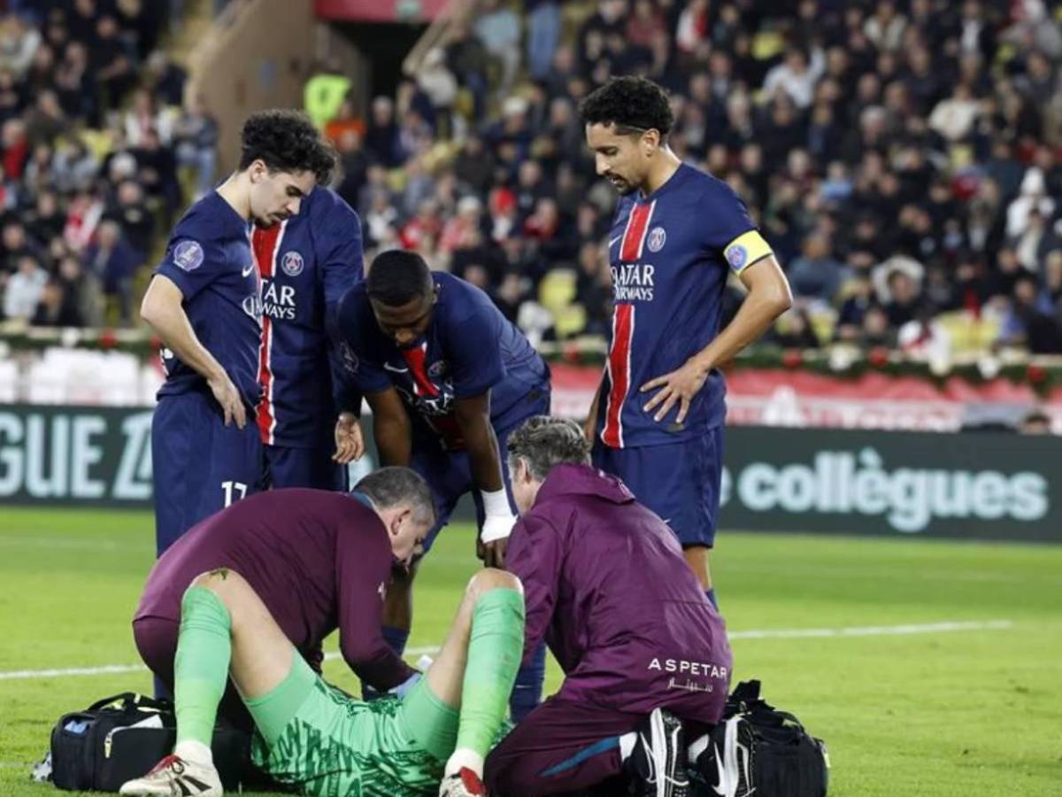 La impactante lesión de Donnaruma que recibió una patada en el rostro y tuvo que ser reemplazado ante Mónaco