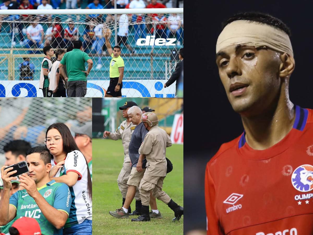 La red de la polémica, sangre en la final Marathón vs Olimpia, estilo Bielsa y el besito que conmovió