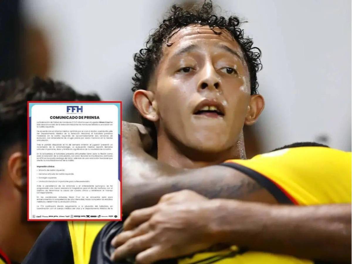 ¡Por el primer triunfo! Así se perfila el 11 titular de Honduras ante Surinam