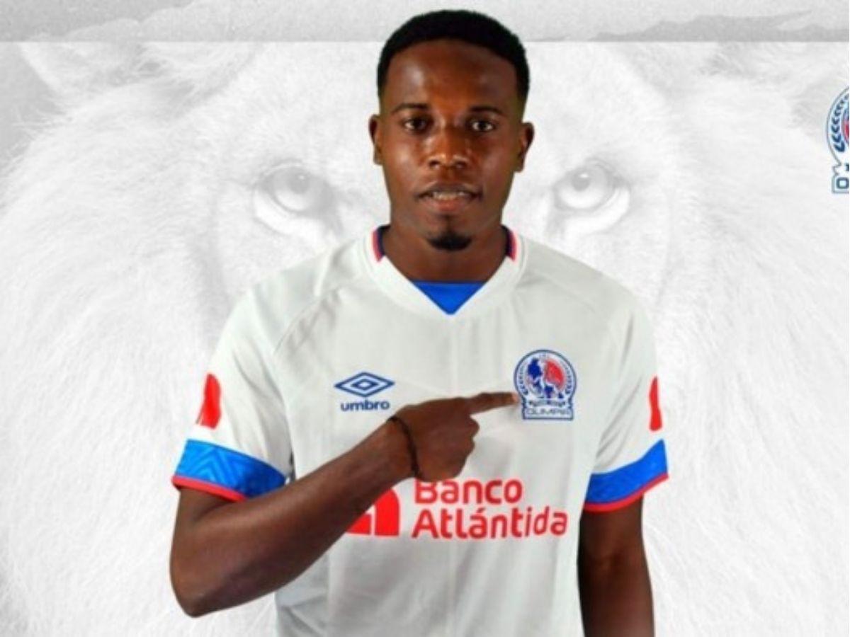 Exjugador de Olimpia revela el viacrucis que vivió por dos años tras sufrir terrible lesión: esta es su realidad