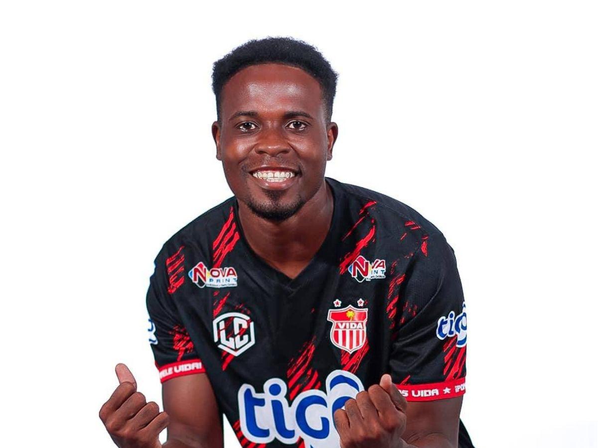 Exjugador de Olimpia revela el viacrucis que vivió por dos años tras sufrir terrible lesión: esta es su realidad