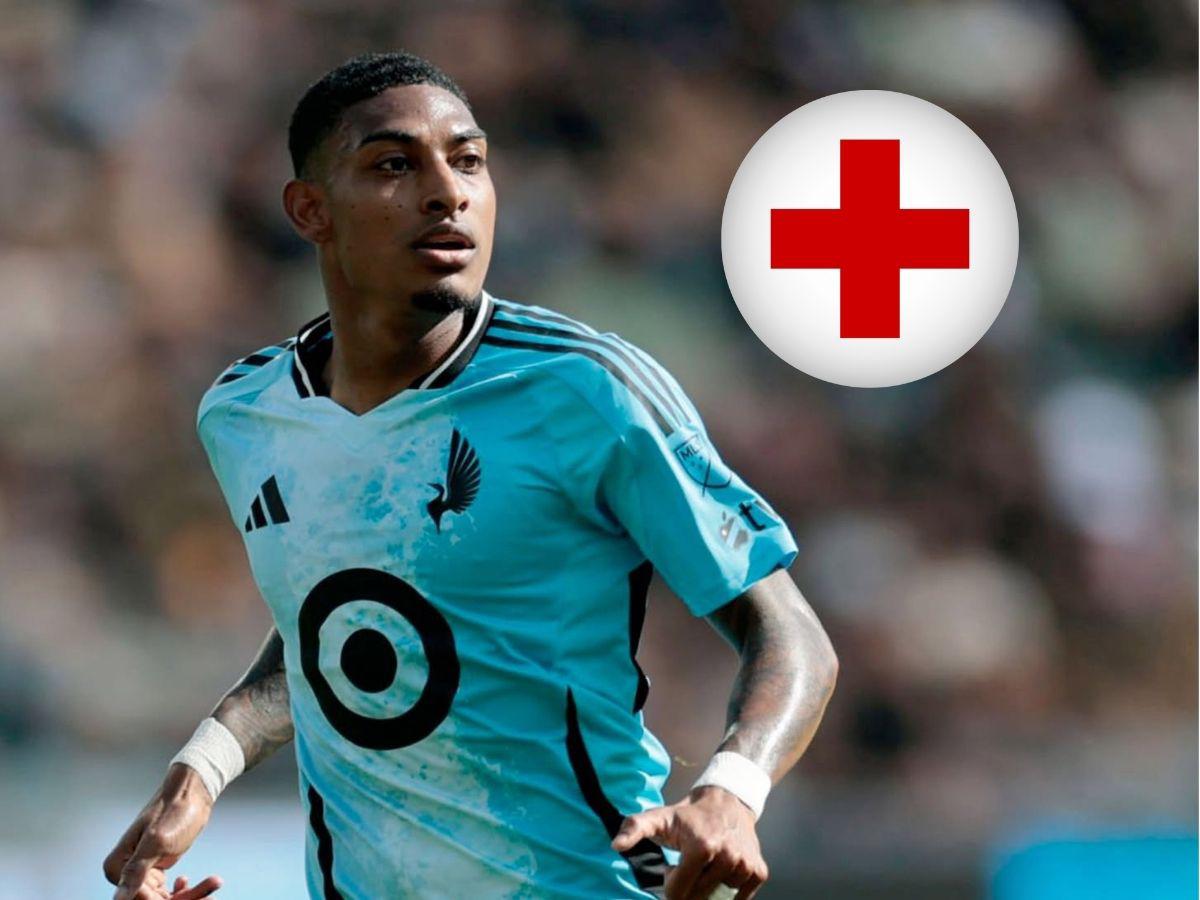 ¡Alarma para Honduras! Joseph Rosales se lesiona con el Minnesota de MLS: este es el tiempo de su recuperación