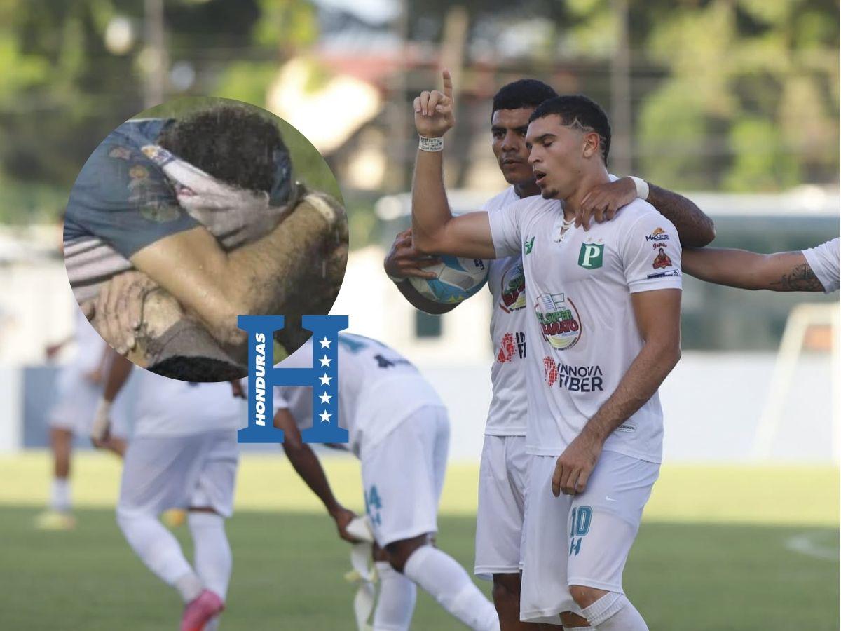 Erick Puerto se confiesa tras convocatoria con Honduras: su momento más duro, el equipo que lo rechazó y el origen de Yío