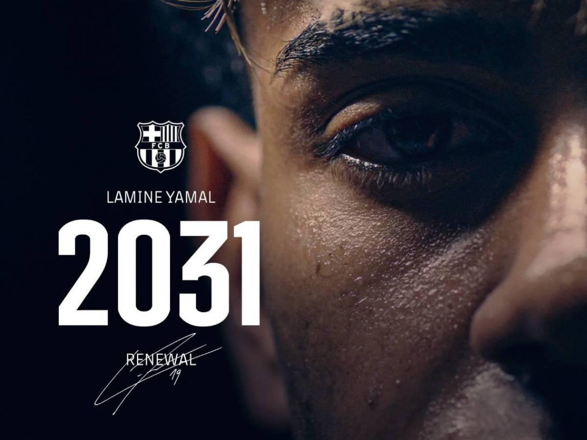 Balón de Oro 2025: así es la vida de millonario de Lamine Yamal; la fortuna que tiene, los negocios que maneja y su salario