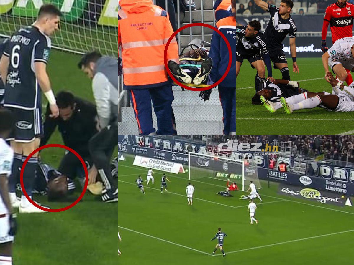 La Premier League es la más peligrosa: La lista de las escalofriantes fracturas de cráneo en el fútbol; uno se retiró