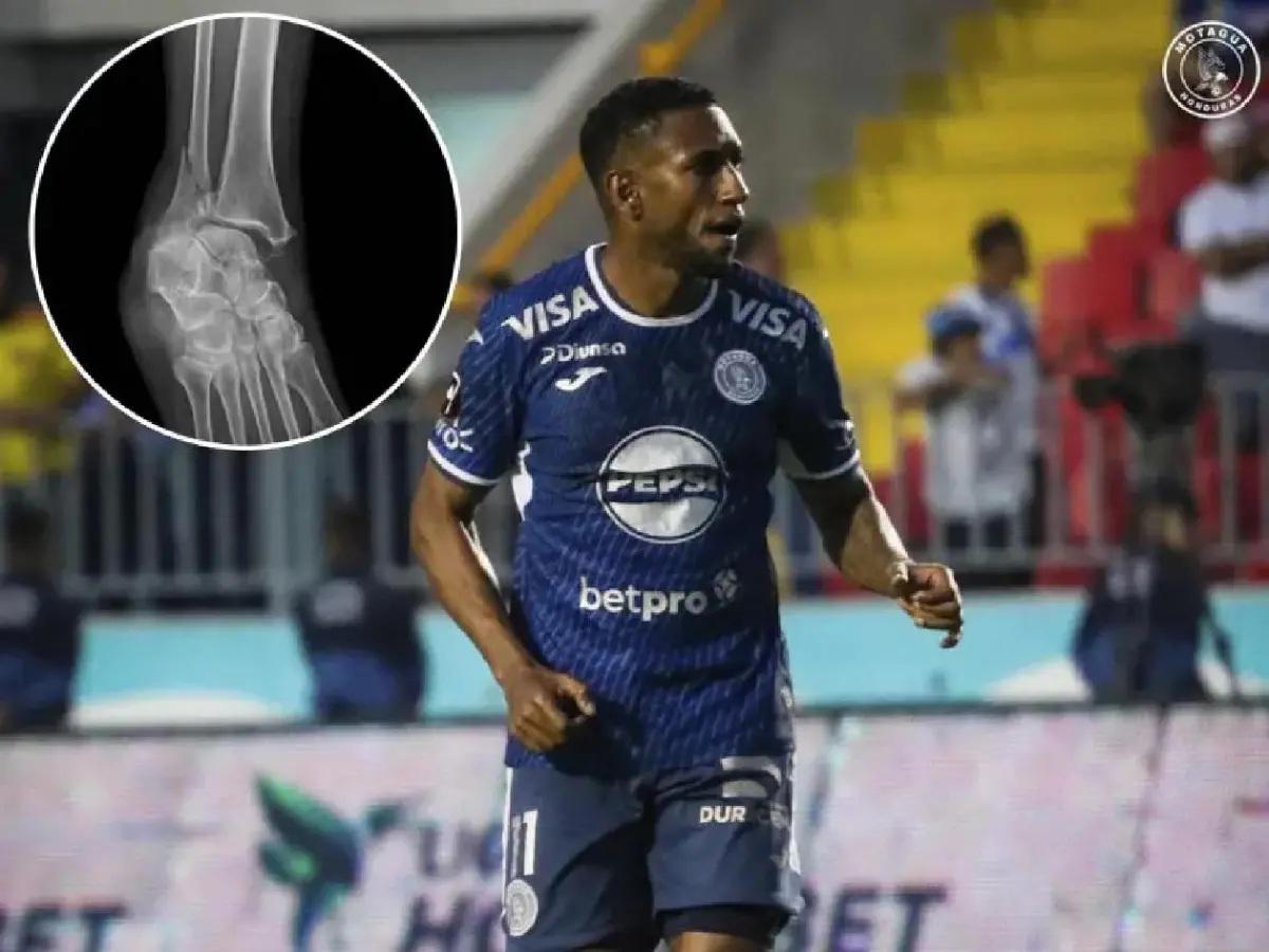 Castigos de Concacaf y lesionados: las bajas de Olimpia, Motagua y Marathón
