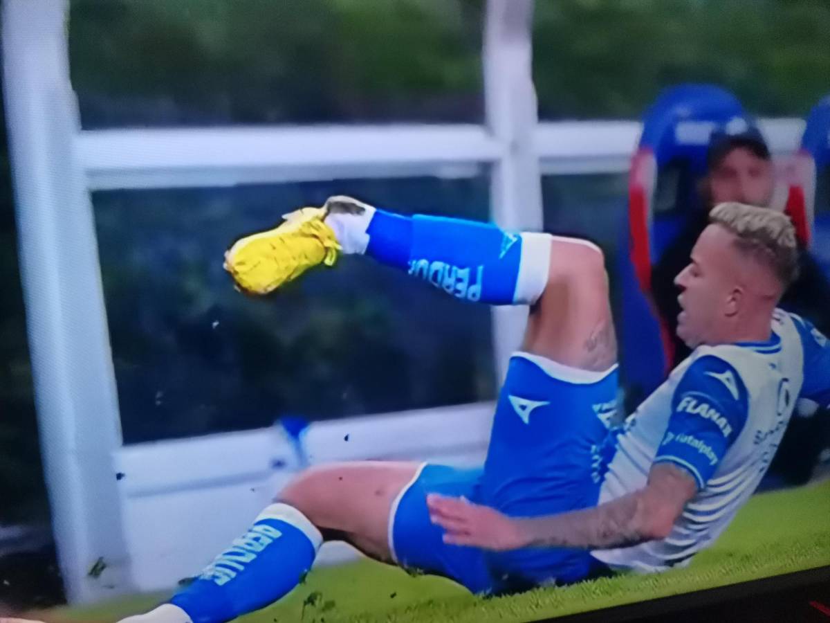 ¡Fuertes imágenes! La espeluznante lesión en la Liga MX: jugador del Puebla se deshace tobillo en desafortunada entrada