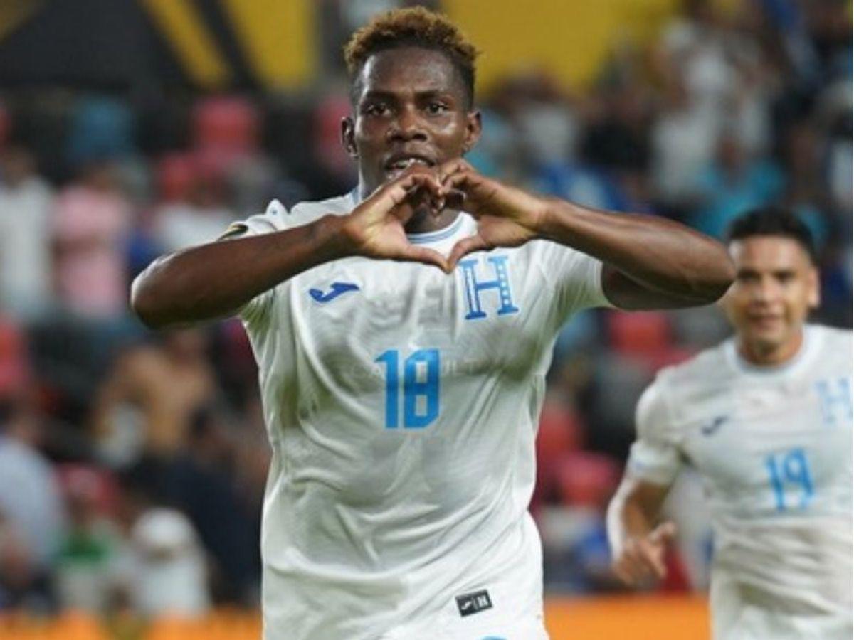 ¡Bajas confirmadas en la Selección de Honduras! Los descartados y lesionados de La H ante Haití por la Eliminatoria