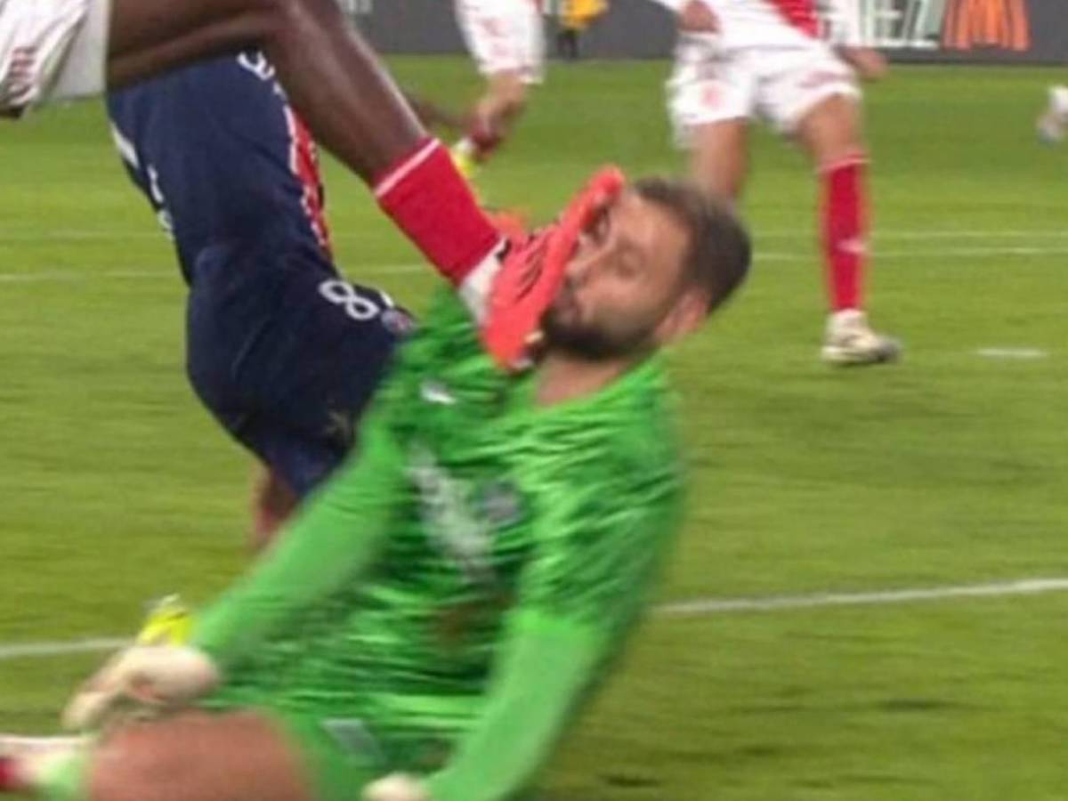 La impactante lesión de Donnaruma que recibió una patada en el rostro y tuvo que ser reemplazado ante Mónaco