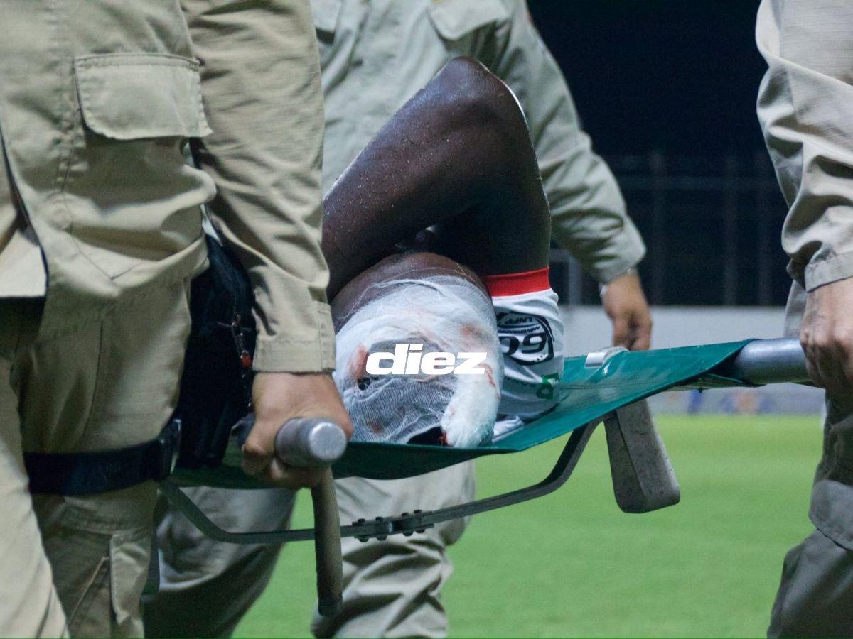 Brutal golpe de futbolista de Real Sociedad, bronca en Real España, las chicas que enamoraron y el fotón a la luna