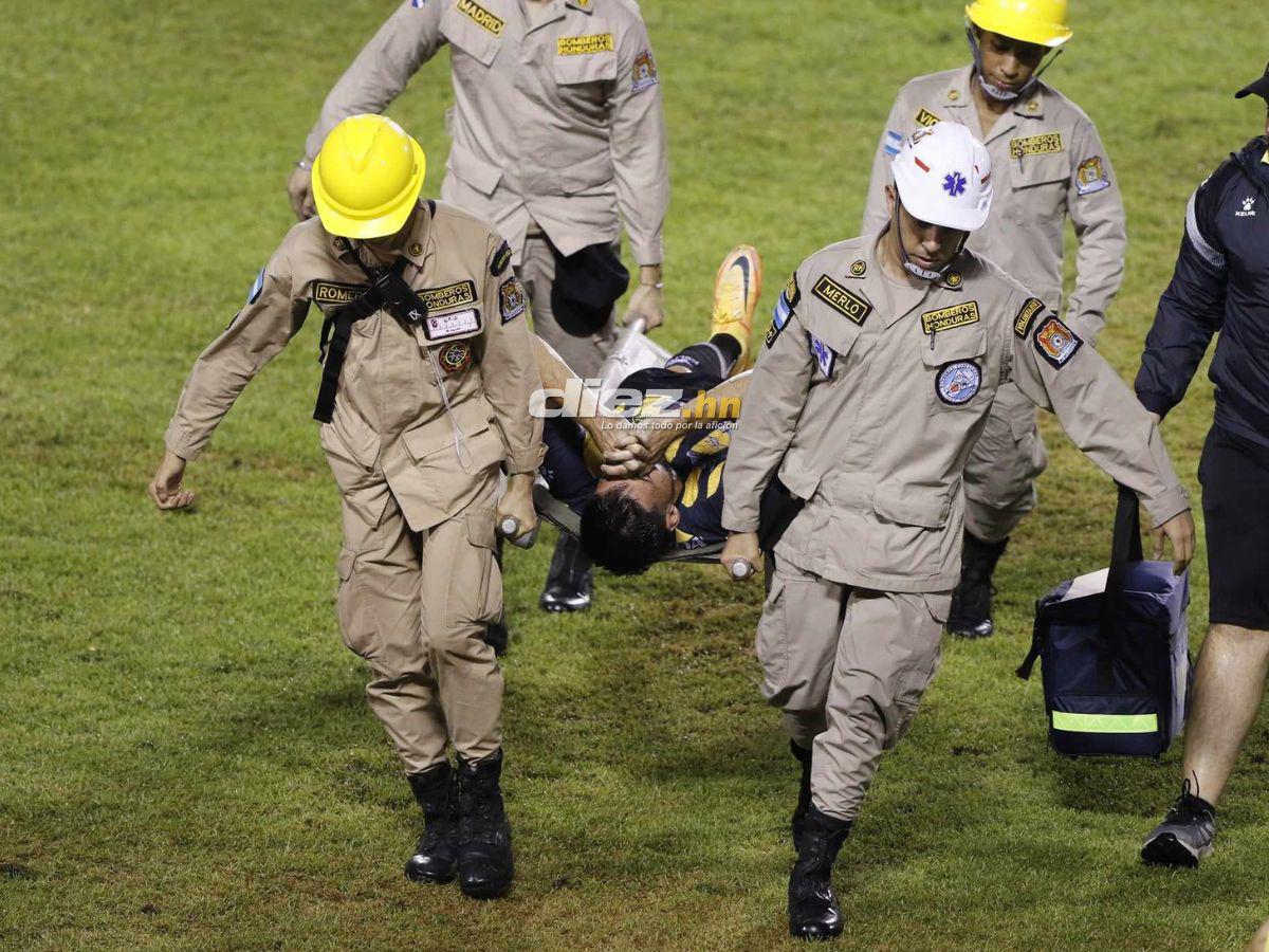 No se vio en TV: Locura de Vieyra en golazo olímpico, la chica que robó miradas en SPS y el aguacero en el Potros-Marathón