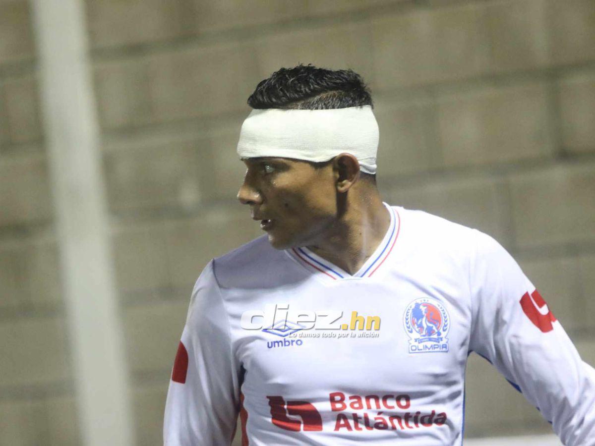 No se vio en TV: Las chicas bellas que enamoraron en la fecha 7, fiesta de la Ultra Fiel, bronca de Olimpia y el emotivo festejo de UPN