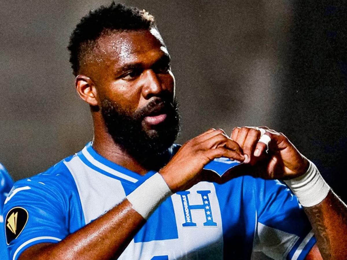 El sorpresivo 11 titular de Honduras ante Perú: este es la primera alineación de José Molina como DT de la Bicolor