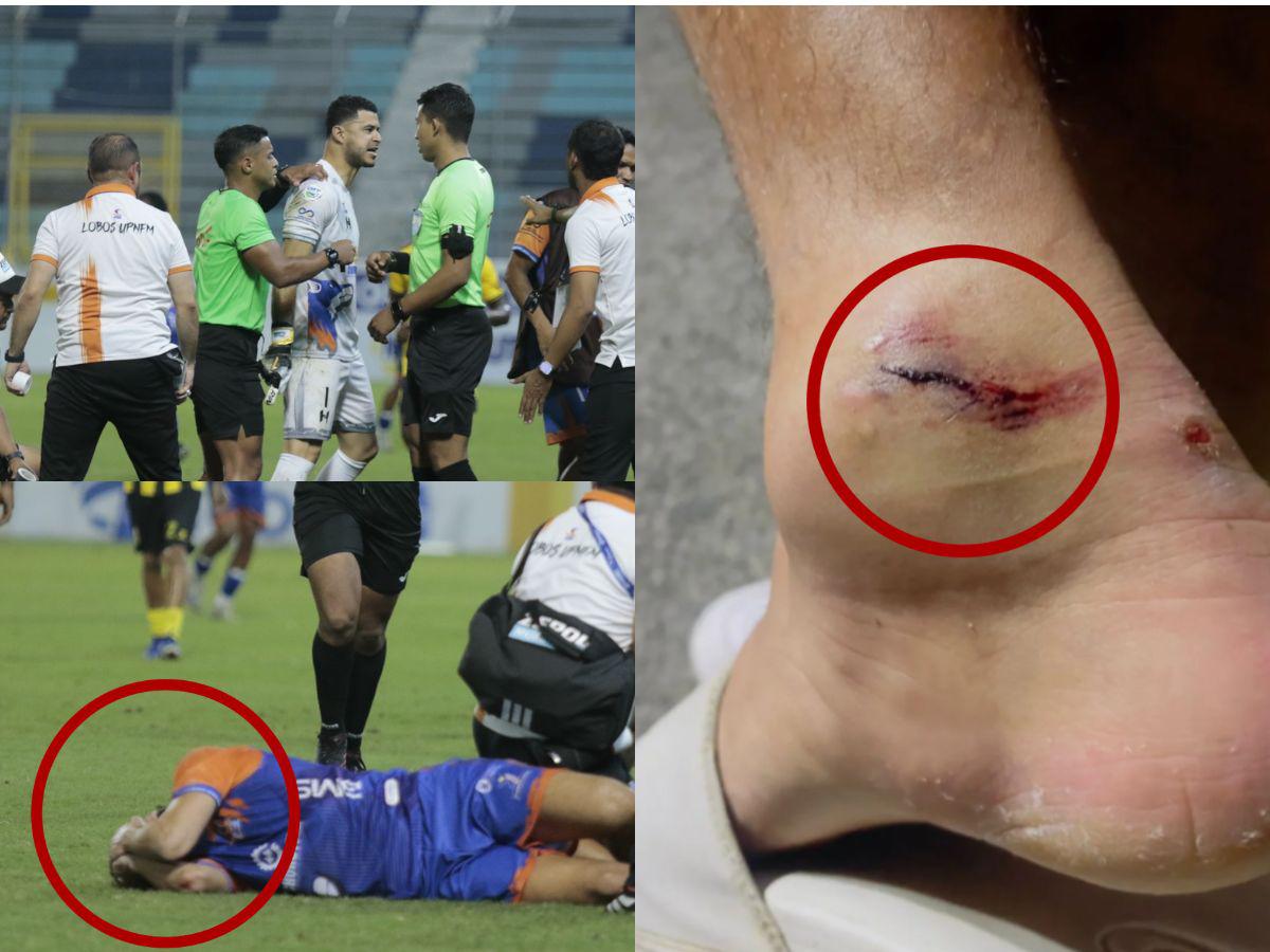 Lobos explota ante el arbitraje por brutal falta contra Marcos Morales frente a Real España: El fútbol exige justicia