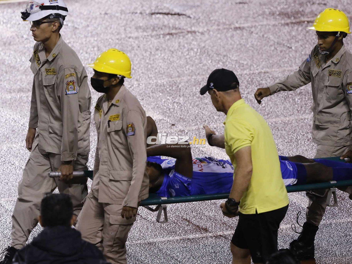 No se vio en TV: Locura de Vieyra en golazo olímpico, la chica que robó miradas en SPS y el aguacero en el Potros-Marathón