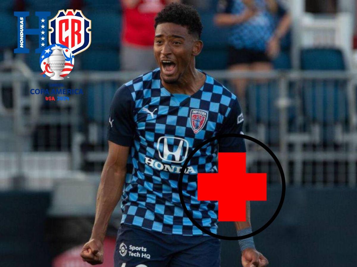 Fenafuth revela si la lesión de Douglas Martínez es de gravedad: ¿se pierde el Honduras vs Costa Rica en Dallas?