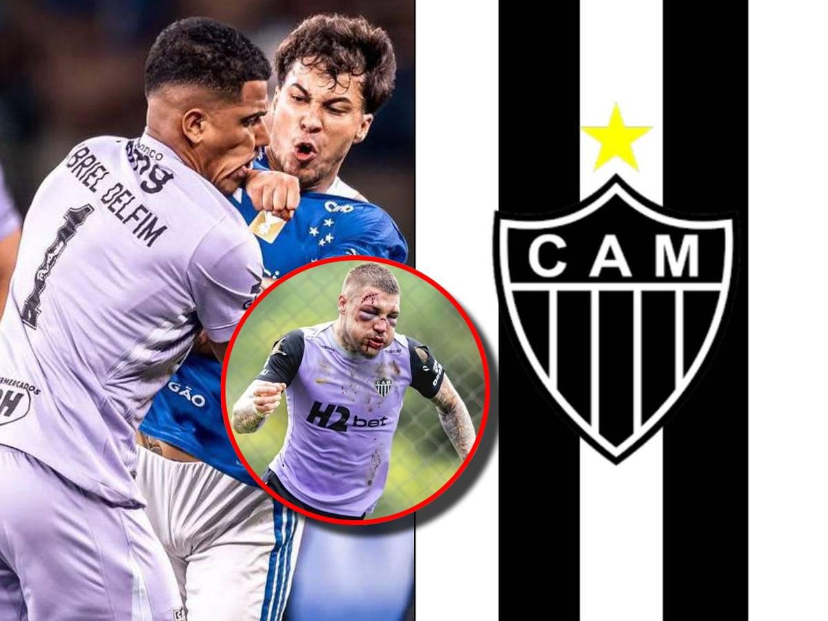 Mineiro lo muestra: así quedaron los rostros de sus jugadores tras la pelea campal y el duro comunicado que agita a Brasil