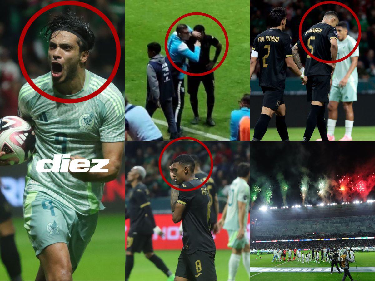 Honduras vivió un infierno: los rostros de tristeza, jugador de “La H” fue atendido con oxígeno y hermoso tifo en el Nemesio Diez