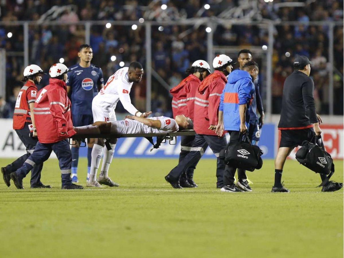 ¡Olimpia tiene cinco bajas ante Motagua! La lista oficial de futbolistas que se pierden la gran final de vuelta del Apertura