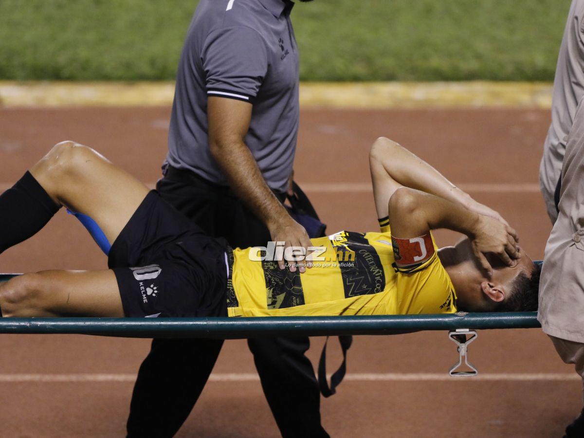 ¿Qué pasó con Falero en conferencia? Tristeza de Olimpia, Real España armó la fiesta y la dolorosa lesión de Jhow Benavídez